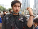 Demo di Patung Kuda “Chaos”, Seorang Pendemo Diduga Terkena Peluru Karet