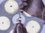 Peran Pemeriksaan D-Dimer Pada Pasien Covid 19