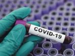 Mempercepat Pemulihan Covid-19 Melalui Pendekatan Sindemi