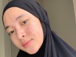 Nissa Sabyan Umumkan Kabar yang Kurang Mengenakan