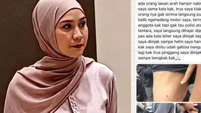 Terkuak, Pelaku Pemukulan Staf Artis Zaskia Merupakan Anggota TNI